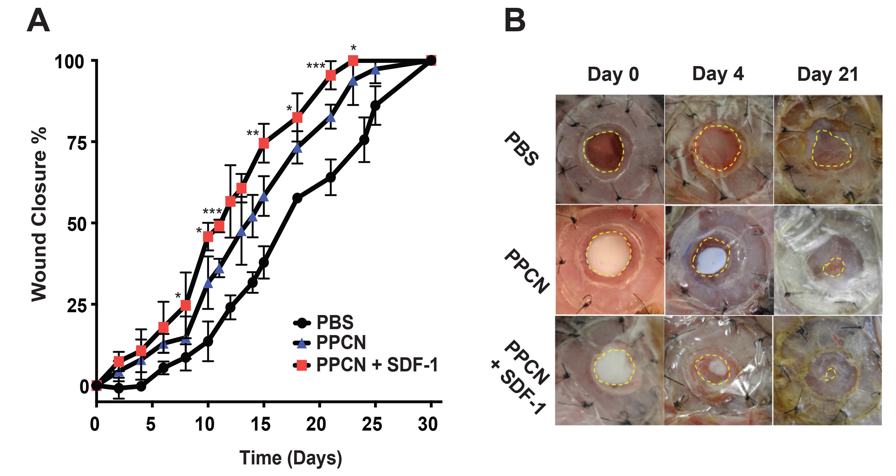 Wound closure images and quantification for wounds treated with protein-releasing hydrogels.